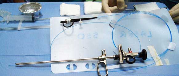 Transurethral Resection Of The Bladder Tumor Cost Treatment Surgery in Mumbai Chennai Delhi Kolkata Hyderabad Bangalore Pune Ahmedabad India