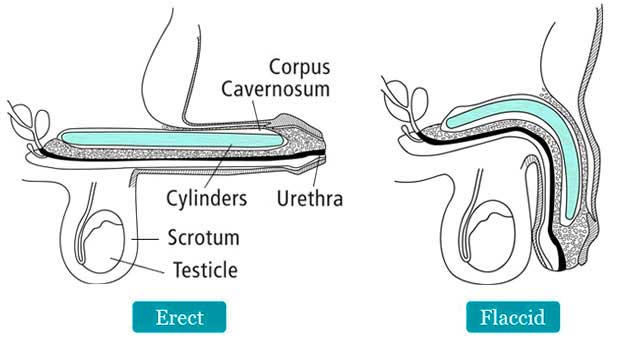 Coloplast Genesis – 1 piece Malleable Penile Implant India cost Surgery Hospital Mumbai, Chennai, Delhi, Kolkata, Hyderabad, Bangalore, Pune, Ahmedabad in India