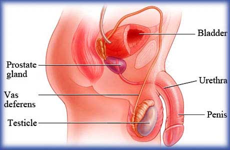 prostate surgery cost in chennai